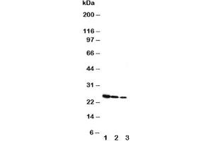 Western blot testing of Growth Hormone antibody and Lane 1:  Recombinant rat GH protein 10ng;  2: 5ng;  3: 2. (Growth Hormone 1 抗体  (AA 27-216))