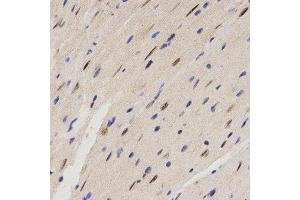 Immunohistochemistry (IHC) image for anti-Family with Sequence Similarity 160, Member B2 (FAM160B2) antibody (ABIN1872648) (FAM160B2 抗体)