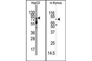 Image no. 1 for anti-MAP/microtubule Affinity-Regulating Kinase 2 (MARK2) (C-Term) antibody (ABIN360425) (MARK2 抗体  (C-Term))