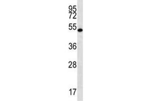 RNF8 antibody western blot analysis in mouse spleen tissue lysate. (RNF8 抗体  (AA 335-364))