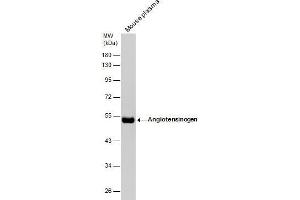 WB Image Mouse tissue extract (50 μg) was separated by 10% SDS-PAGE, and the membrane was blotted with Angiotensinogen antibody [N1C3] , diluted at 1:1000. (AGT 抗体)