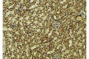 ABIN6277519 at 1/100 staining Mouse kidney tissue by IHC-P. (PRKACB 抗体  (C-Term))