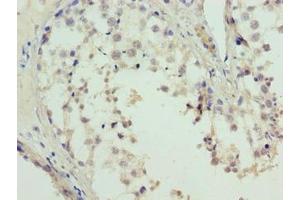 Immunohistochemistry of paraffin-embedded human testis tissue using ABIN7158010 at dilution of 1:100 (L3MBTL4 抗体  (AA 1-270))