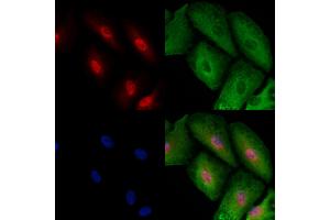 ABIN6257451 and ABIN6273495 staining  cells by IF/ICC. (RAD1 抗体  (Internal Region))