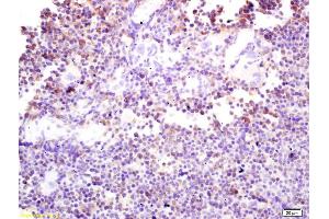 Formalin-fixed and paraffin embedded mouse spleen labeled with Rabbit Anti phospho-DAB2 (Ser24) Polyclonal Antibody, Unconjugated (ABIN1386225) at 1:200 followed by conjugation to the secondary antibody and DAB staining (DAB2 抗体  (pSer24))