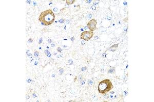 Immunohistochemistry of paraffin-embedded rat brain using NRG4 antibody (ABIN3016309, ABIN3016310, ABIN3016311 and ABIN6219713) at dilution of 1:100 (40x lens). (Neuregulin 4 抗体  (AA 1-115))