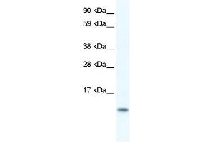 FXYD5 antibody used at 0. (FXYD5 抗体  (N-Term))