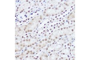 Immunohistochemistry of paraffin-embedded mouse kidney using S Rabbit pAb (ABIN6132631, ABIN6147390, ABIN6147391 and ABIN6224669) at dilution of 1:100 (40x lens). (SART1 抗体  (AA 1-255))