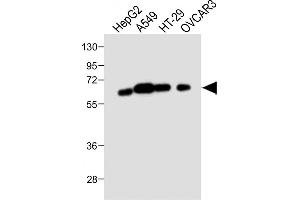 All lanes : Anti-CYP3A4 Antibody (Center) at 1:1000 dilution Lane 1: HepG2 whole cell lysate Lane 2: A549 whole cell lysate Lane 3: HT-29 whole cell lysate Lane 4: OVCAR3 whole cell lysate Lysates/proteins at 20 μg per lane. (CYP3A4 抗体  (AA 228-255))