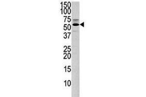 Western blot analysis of PTEN antibody and 293 lysate. (PTEN 抗体  (AA 371-403))