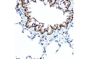 Immunohistochemistry of paraffin-embedded rat lung using FOX Rabbit pAb (5278) at dilution of 1:100 (40x lens). (FOXA1 抗体  (AA 263-472))