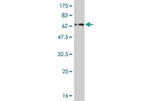 Western Blot detection against Immunogen (59. (ZNF215 抗体  (AA 1-304))