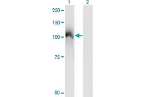 Western Blot analysis of CBL expression in transfected 293T cell line by CBL monoclonal antibody (M01), clone 6D12. (CBL 抗体  (AA 736-835))