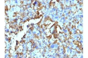 Image no. 3 for anti-Major Histocompatibility Complex, Class II, DR beta 1 (HLA-DRB1) antibody (ABIN6186381)