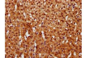 IHC image of ABIN7153551 diluted at 1:400 and staining in paraffin-embedded human adrenal gland tissue performed on a Leica BondTM system. (GGCT 抗体  (AA 54-188))