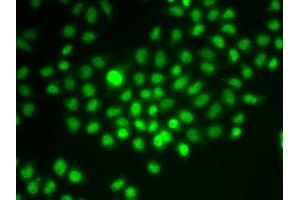 Immunofluorescence analysis of HeLa cells using SMARCE1 antibody. (SMARCE1 抗体)