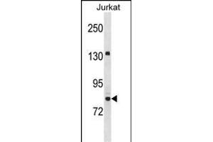 UHRF2 Antibody (Center) (ABIN1538450 and ABIN2850120) western blot analysis in Jurkat cell line lysates (35 μg/lane). (UHRF2 抗体  (AA 479-508))