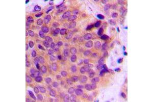 Immunohistochemistry (IHC) image for anti-Matrix Metalloproteinase 2 (MMP2) (C-Term) antibody (ABIN7296312)