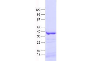 Validation with Western Blot (CSNK1A1L Protein (Isoform alpha) (His tag))