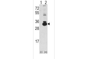Western blot analysis of KHK using rabbit polyclonal Ketohexokinase (KHK) Antibody using 293 cell lysates (2 ug/lane) either nontransfected (Lane 1) or transiently transfected with the KHK gene (Lane 2). (Ketohexokinase 抗体  (C-Term))