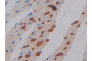 Immunohistochemistry (IHC) image for anti-CD274 (PD-L1) (AA 48-290) antibody (ABIN7432613)