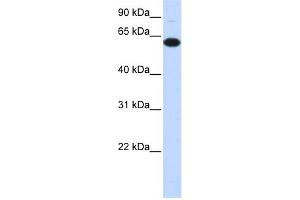 WB Suggested Anti-FBXO24 Antibody Titration:  0. (FBXO24 抗体  (Middle Region))