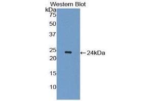 Western Blotting (WB) image for anti-Interleukin 1 Receptor Antagonist (IL1RN) (AA 26-176) antibody (ABIN3209021) (IL1RN 抗体  (AA 26-176))