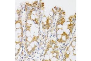 Immunohistochemistry of paraffin-embedded human rectum using MYO5A antibody (ABIN6003562) at dilution of 1/100 (40x lens). (MYO5A 抗体)
