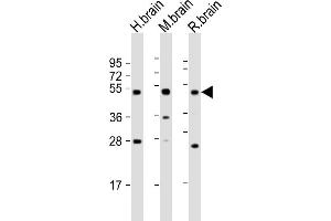 All lanes : Anti-NPTX1 Antibody at 1:2000 dilution Lane 1: human brain lysate Lane 2: mouse brain lysate Lane 3: rat brain lysate Lysates/proteins at 20 μg per lane. (NPX1 抗体  (AA 322-350))