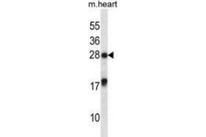 Western blot analysis in mouse heart tissue lysates (35ug/lane) using MXI1 Antibody . (MXI1 抗体  (Middle Region))