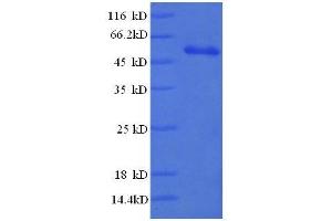 SDS-PAGE (SDS) image for CD3 epsilon (CD3E) (AA 23-207), (full length) protein (GST tag) (ABIN1095763)
