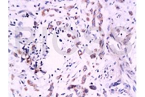 Immunohistochemistry (IHC) image for anti-V-Set Domain Containing T Cell Activation Inhibitor 1 (VTCN1) (AA 50-100) antibody (ABIN671736)