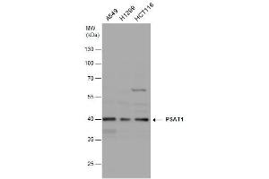 WB Image PSAT1 antibody [N1C3] detects PSAT1 protein by western blot analysis. (PSAT1 抗体)