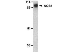 Western blot analysis of ACE2 in human kidney lysate with AP30008PU-N ACE2 antibody at 1 μg/ml. (ACE2 抗体  (N-Term))