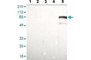 Western blot analysis of Lane 1: RT-4 cell lysate, Lane 2: U-251 MG sp cell lysate, Lane 3: A-431 cell lysate, Lane 4: Human liver tissue, Lane 5: Human tonsil tissue with BTK polyclonal antibody  at 1:100 - 1:250 dilution. (BTK 抗体  (AA 206-351))