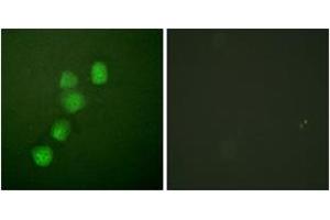 Immunofluorescence analysis of HuvEc cells, using Cyclin E1 (Ab-395) Antibody.