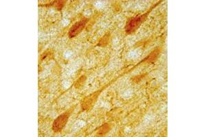 IHC image of neurons in rat cortex. (Serotonin Receptor 1A 抗体  (AA 294-312))