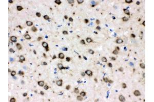 Immunohistochemistry (IHC) image for anti-Chaperonin Containing TCP1, Subunit 4 (Delta) (CCT4) (AA 452-539) antibody (ABIN4886514)