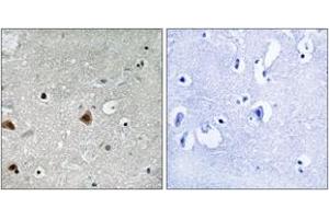 Immunohistochemistry analysis of paraffin-embedded human brain, using COPS1 (Phospho-Ser454) Antibody. (GPS1 抗体  (pSer454))