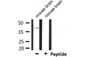 Western blot analysis of extracts from mouse brain, using CD2 Tail-binding Antibody. (CD2BP2 抗体  (Internal Region))
