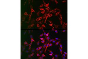 Immunofluorescence analysis of NIH/3T3 cells using LRP5 Rabbit pAb (ABIN1513164, ABIN3020644, ABIN3020646 and ABIN6213630) at dilution of 1:200 (40x lens). (LRP5 抗体  (AA 1000-1250))