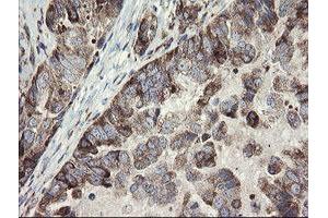 Image no. 6 for anti-Methionyl Aminopeptidase 2 (METAP2) (AA 2-212) antibody (ABIN1491153)