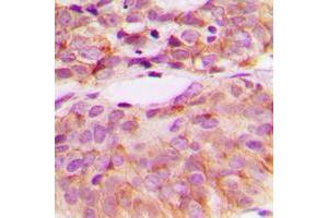Immunohistochemistry (IHC) image for anti-Proto-oncogene tyrosine-protein kinase Src (Src) (C-Term), (pTyr529) antibody (ABIN7297014)