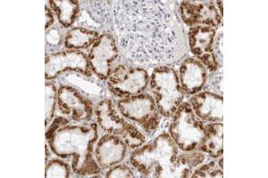 Immunohistochemical staining of human kidney with CNBD1 polyclonal antibody  shows strong cytoplasmic positivity in cells in tubules at 1:200-1:500 dilution. (CNBD1 抗体)