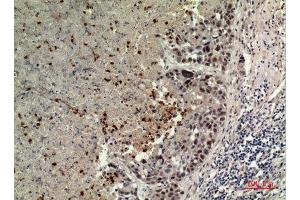 Immunohistochemistry (IHC) analysis of paraffin-embedded Human Lung, antibody was diluted at 1:100. (BCAT1 抗体  (Internal Region))