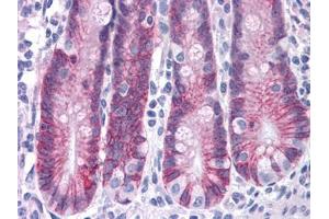Human Small Intestine: Formalin-Fixed, Paraffin-Embedded (FFPE) (ASAH2 抗体  (C-Term))