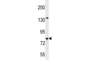 CPT1B antibody western blot analysis in SK-BR-3 lysate (CPT1B 抗体  (AA 744-770))