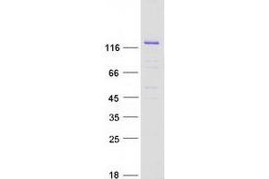 Western Blotting (WB) image for Ras Protein-Specific Guanine Nucleotide-Releasing Factor 1 (RASGRF1) (Transcript Variant 1) protein (Myc-DYKDDDDK Tag) (ABIN2712357)