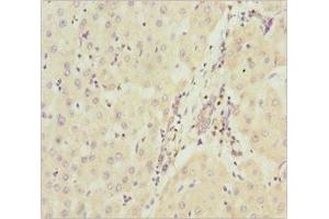 Immunohistochemistry (IHC) image for anti-NADH Dehydrogenase (Ubiquinone) 1 alpha Subcomplex, 9, 39kDa (NDUFA9) (AA 1-270) antibody (ABIN7160913)