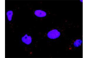 Proximity Ligation Analysis of protein-protein interactions between MAPK11 and MAP3K7IP1. (MAPK11 抗体  (AA 1-364))